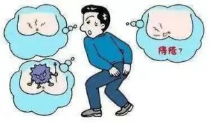 【四院|科普】：大便出血就是得了痔疮？这6个肛肠疾病认识误区您要知道！
