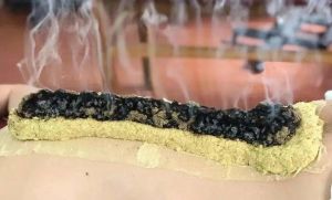 【四院|科普】：骄阳似火三伏天，扶阳驱寒治正当时