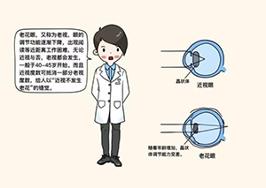 一文读懂老花眼：人人都可能遇到的眼部问题
